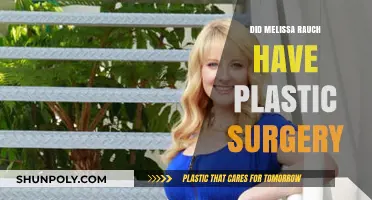Melissa Rauch's Transformation: Plastic Surgery Speculations and Truths