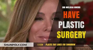Melissa Rivers' Transformation: Plastic Surgery Speculations and Truths Revealed