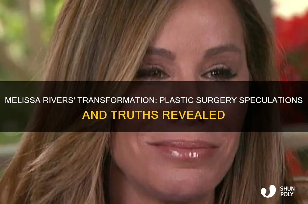 did melissa rivers have plastic surgery