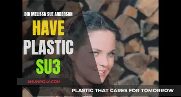 Melissa Sue Anderson's Plastic Surgery: What's the Truth?