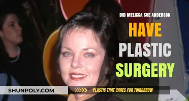 Melissa Sue Anderson's Transformation: Plastic Surgery Speculations Explored