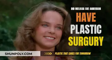 Melissa Sue Anderson's Plastic Surgery: What's the Truth?