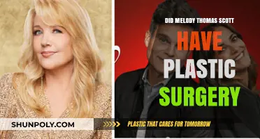 Melody Thomas Scott's Transformation: Plastic Surgery Speculations Explored