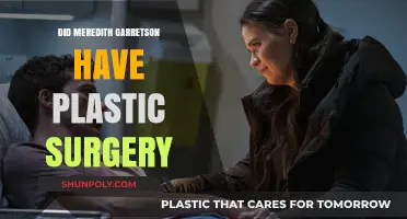 Did Meredith Garretson Undergo Plastic Surgery? Unveiling the Truth