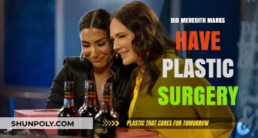 Meredith Marks Plastic Surgery: Fact-Checking the Rumors and Speculations