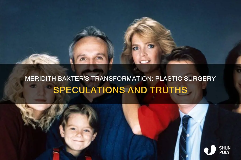 did meridith baxter have plastic surgery