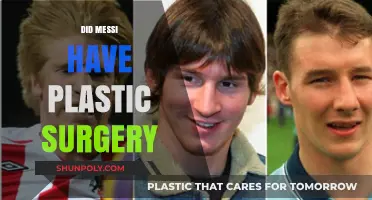 Did Messi Undergo Plastic Surgery? Unveiling the Truth Behind the Rumors