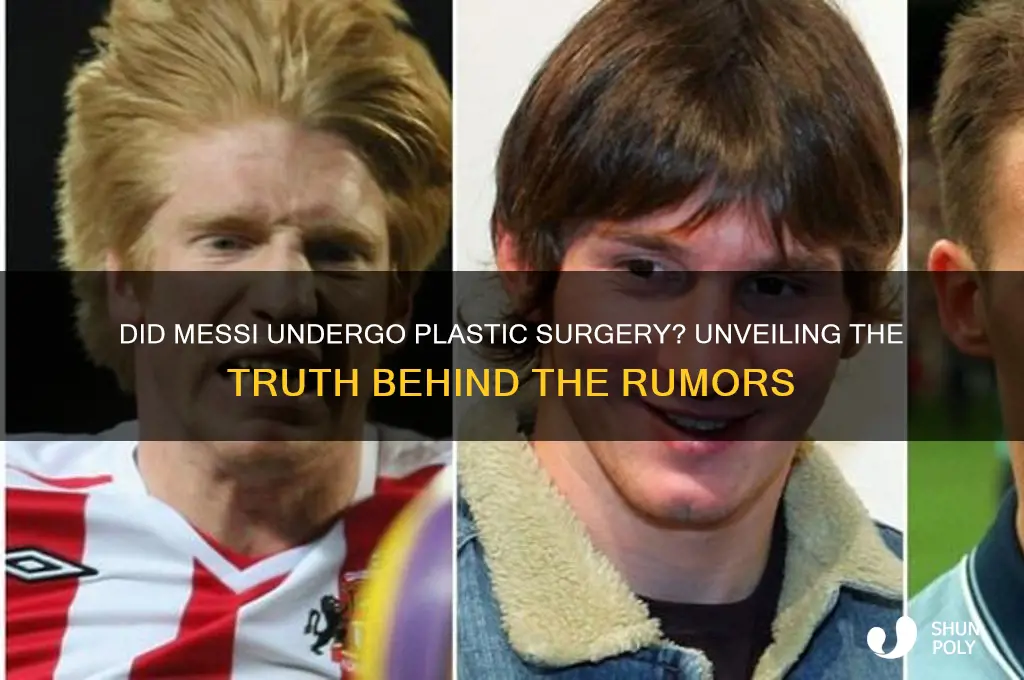 did messi have plastic surgery