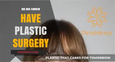 Mia Farrow's Transformation: Plastic Surgery Speculations and Truths Revealed
