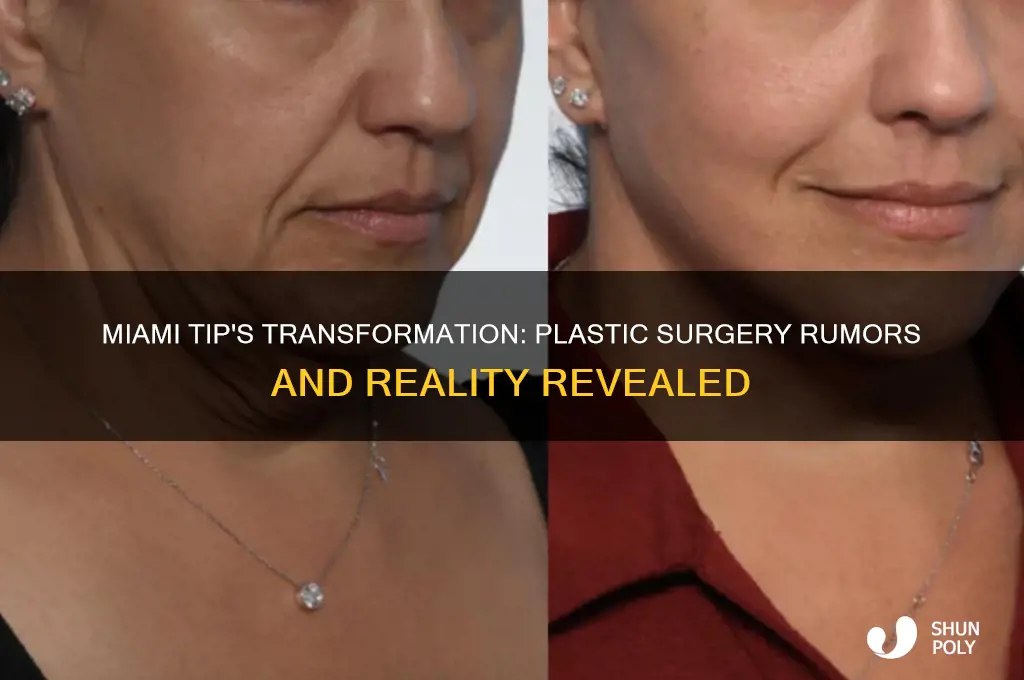 did miami tip have plastic surgery