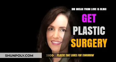 Micah's Transformation: Plastic Surgery Speculations from Love is Blind