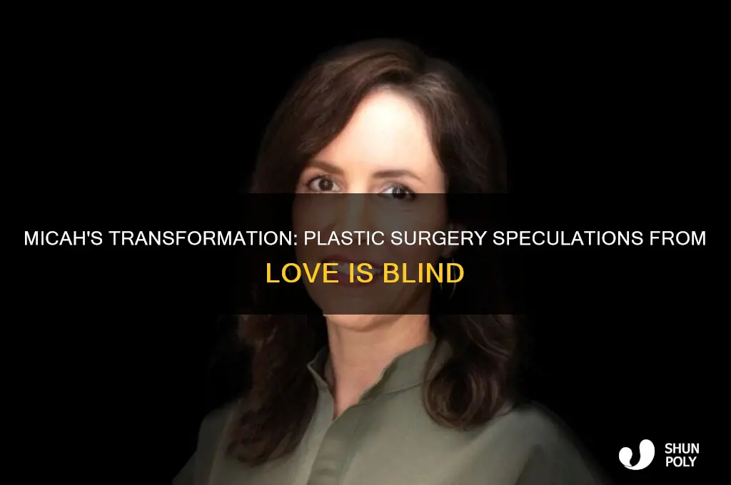 did micah from love is blind get plastic surgery