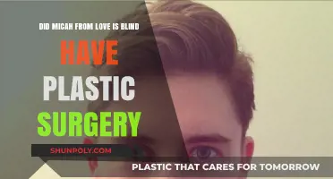 Micah Love is Blind Plastic Surgery: Fact or Fiction?