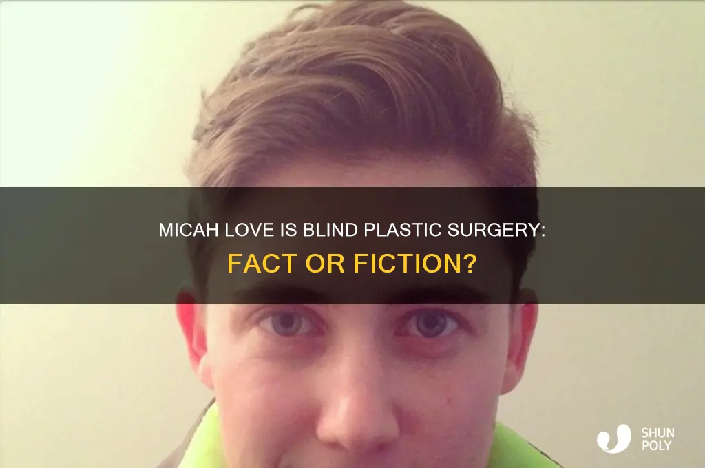 did micah from love is blind have plastic surgery