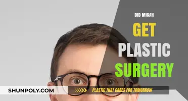 Micah's Transformation: Plastic Surgery Rumors and the Truth Behind Them