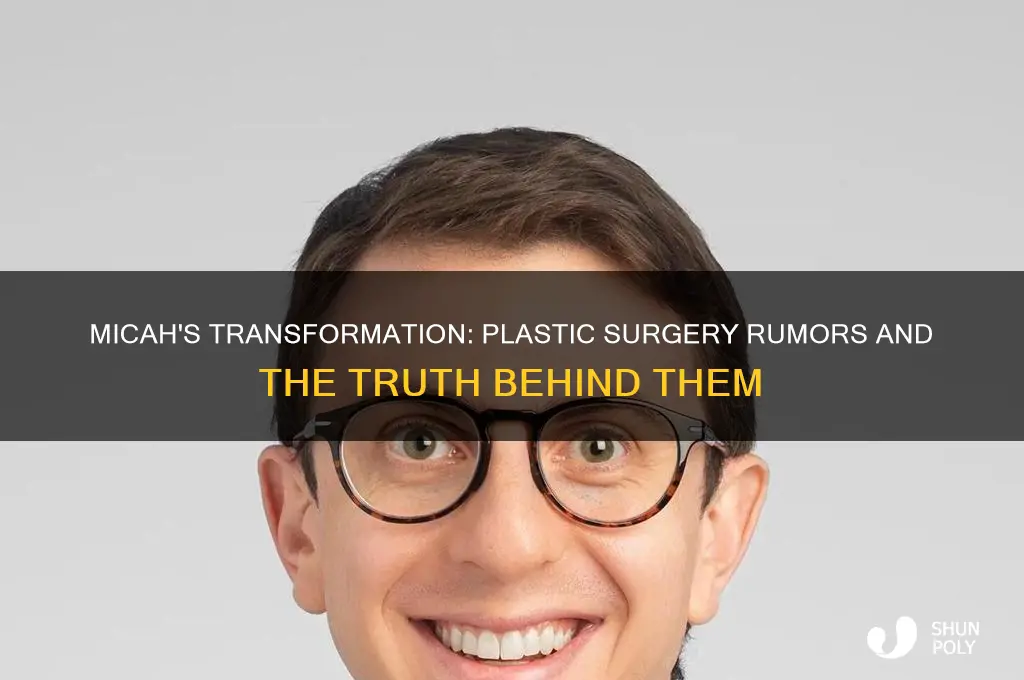 did micah get plastic surgery