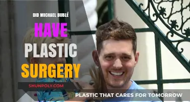 Michael Bublé's Transformation: Plastic Surgery Rumors Explored and Debunked