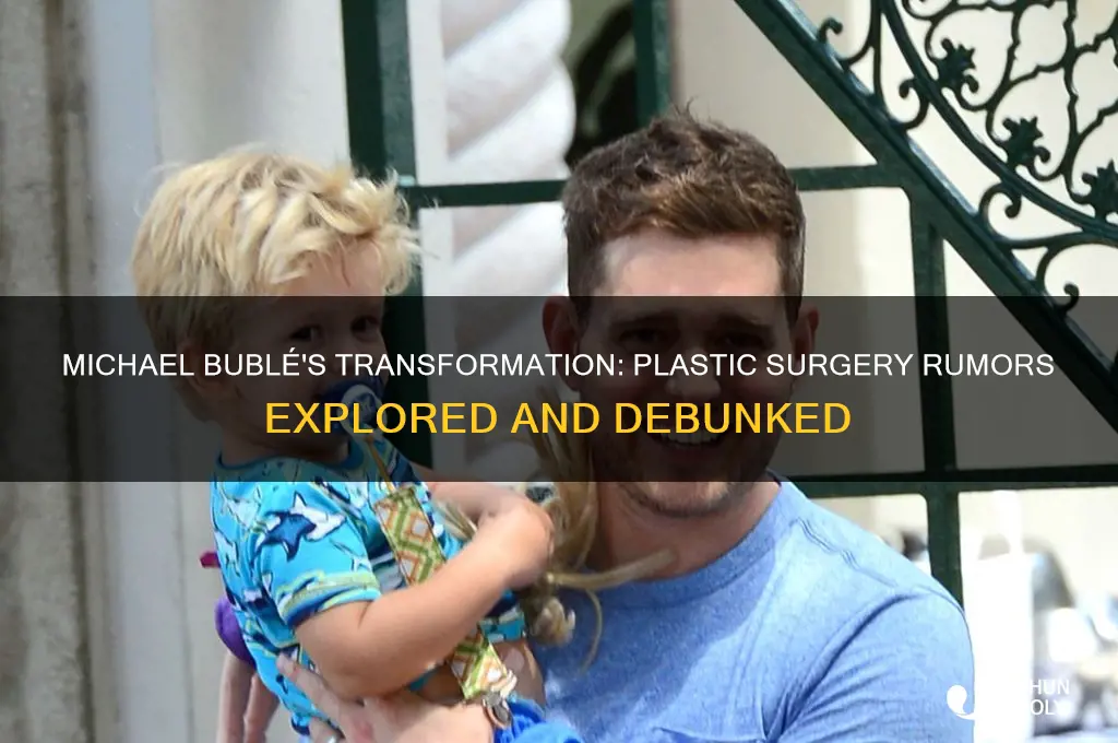 did michael bublé have plastic surgery