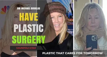 Michael Douglas Plastic Surgery: Fact-Checking the Transformation Rumors