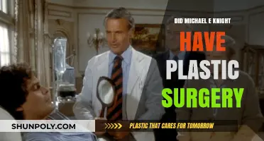 Michael E. Knight's Transformation: Plastic Surgery Rumors Explored