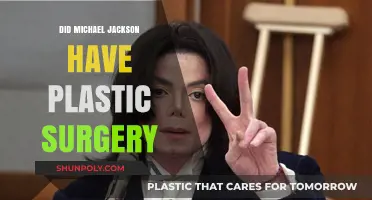 Michael Jackson's Transformation: Unveiling the Truth About His Plastic Surgery