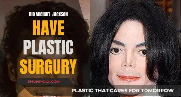 Plastic Surgery: Michael Jackson's Transformation and Procedures