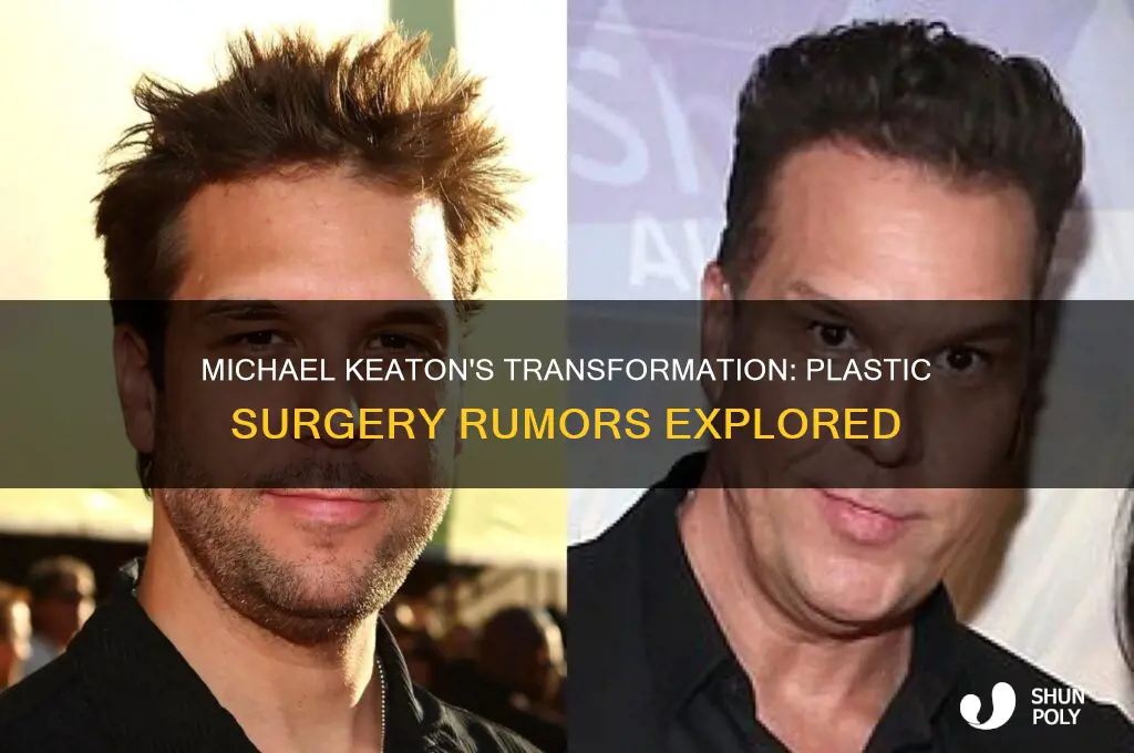 did michael keaton have plastic surgery