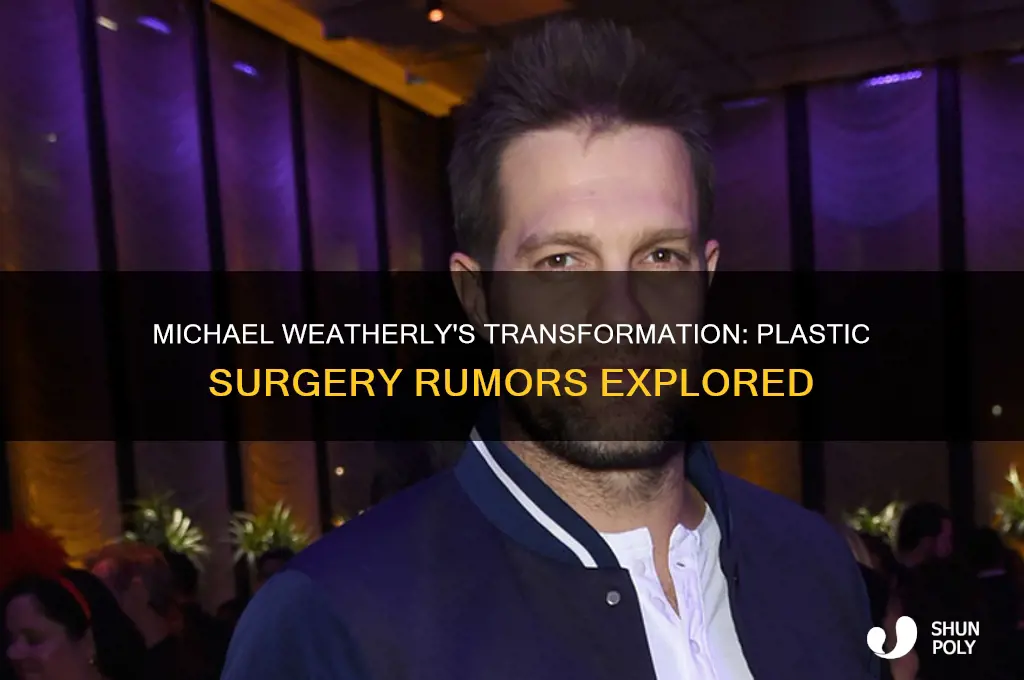 did michael weatherly have plastic surgery