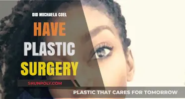 Michaela Coel's Transformation: Plastic Surgery Speculations and Truths