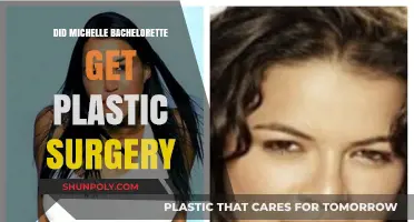 Michelle Young's Bachelorette Transformation: Plastic Surgery Speculations Explored