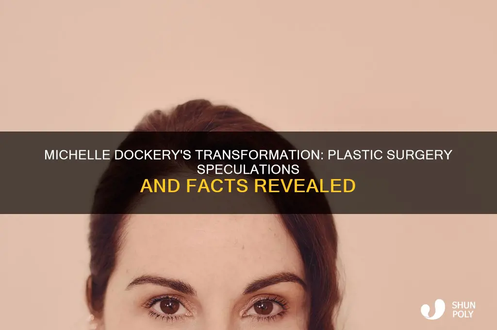 did michelle dockery have plastic surgery