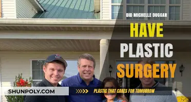 Michelle Duggar's Transformation: Plastic Surgery Rumors Explored