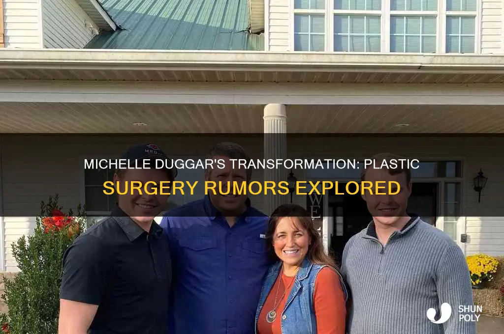 did michelle duggar have plastic surgery