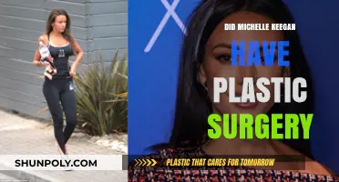 Michelle Keegan's Transformation: Plastic Surgery Speculations and Truths Revealed
