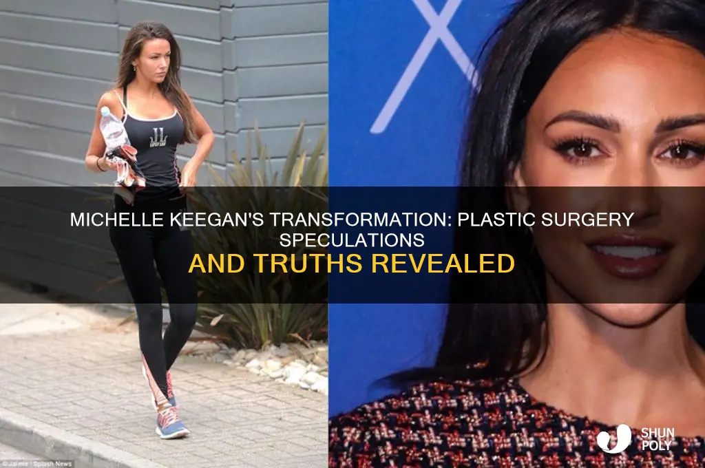 did michelle keegan have plastic surgery
