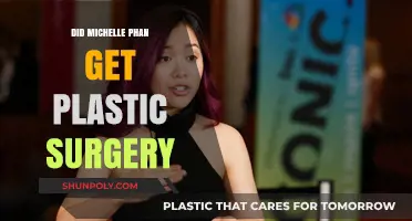 Michelle Phan's Transformation: Plastic Surgery Speculations and Truths Revealed