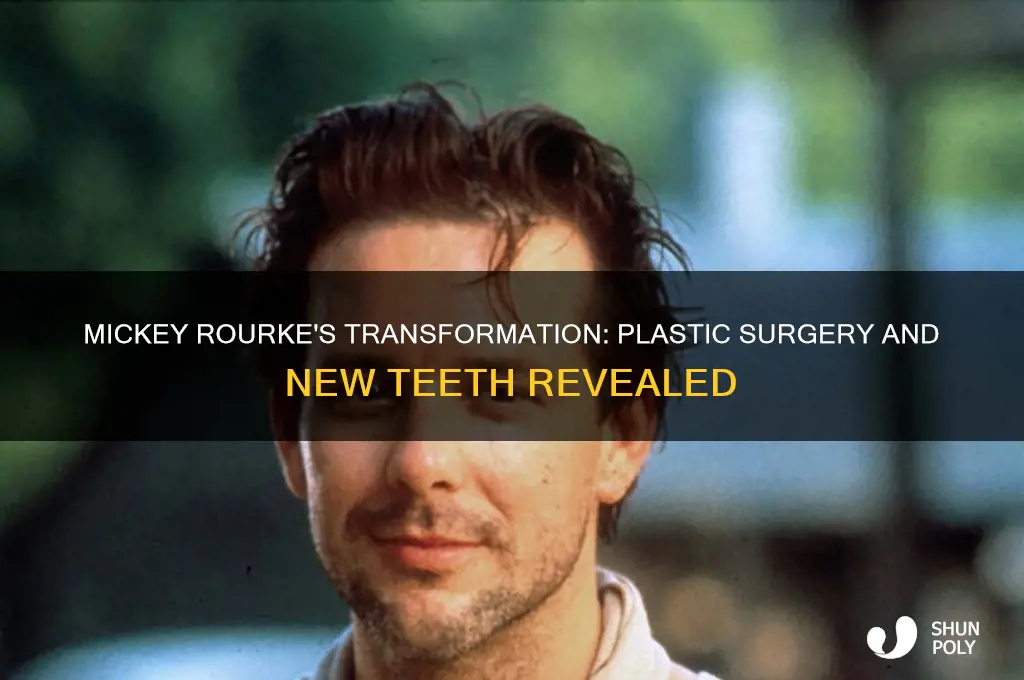 did mickey rourke get plastic surgery with new teeth
