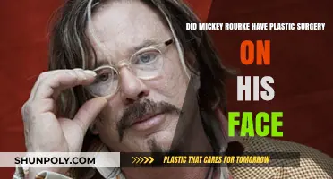 Mickey Rourke's Face Transformation: Plastic Surgery Speculations Explored