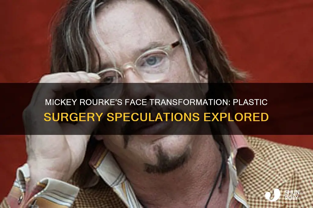 did mickey rourke have plastic surgery on his face