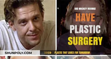 Mickey Rourke's Transformation: Unveiling the Truth About His Plastic Surgery