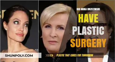 Mika Brzezinski's Transformation: Plastic Surgery Speculations and Truths