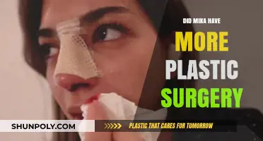 Mika's Transformation: Unveiling the Truth About Plastic Surgery Rumors