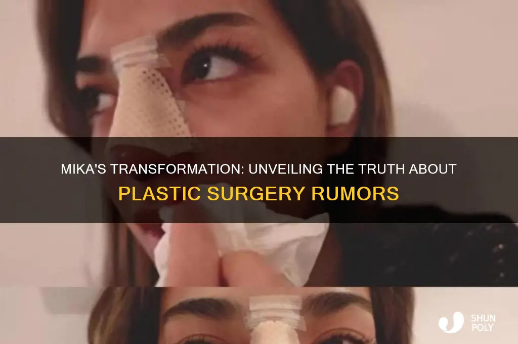 did mika have more plastic surgery