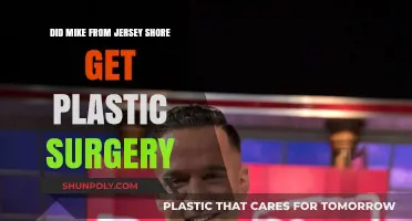 Mike from Jersey Shore Plastic Surgery: Fact or Fiction?