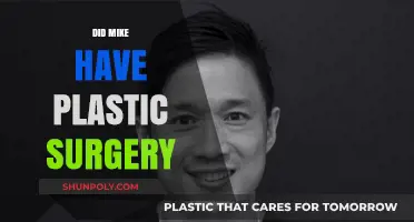 Mike's Transformation: Plastic Surgery Rumors and the Truth Behind Them