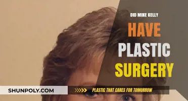 Mike Kelly Plastic Surgery: Fact-Checking the Rumors and Speculations