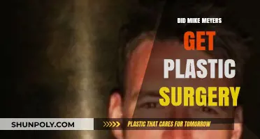Mike Meyers Plastic Surgery: Fact-Checking the Transformation Rumors
