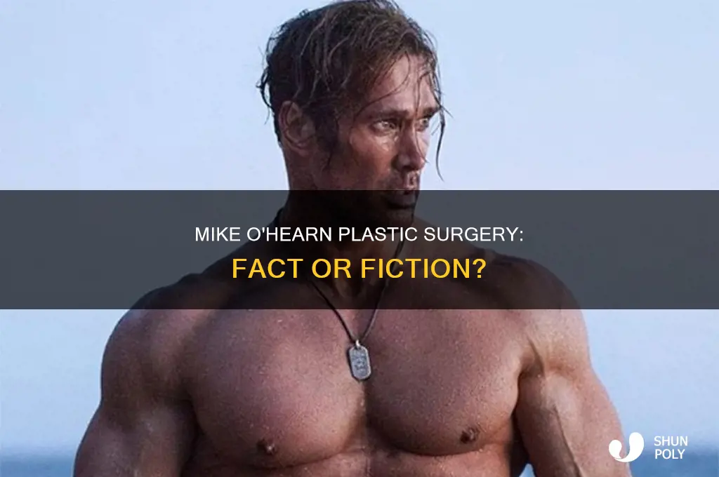 did mike ohearn have plastic surgery