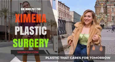 Mike's Role in Ximena's Plastic Surgery: Fact or Fiction?