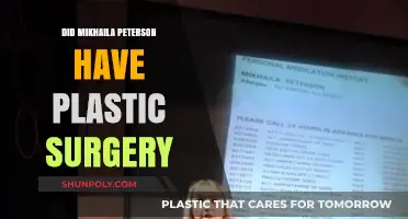 Mikhaila Peterson's Transformation: Plastic Surgery Speculations and Facts
